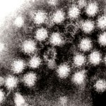 Норовирус под электронным микроскопом